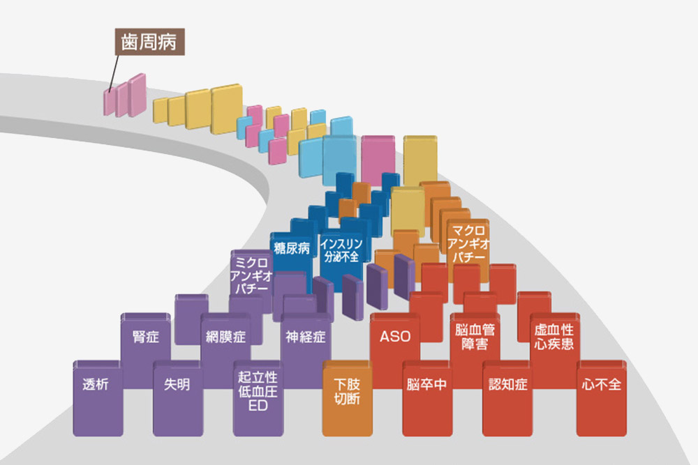 歯周病リスクと予防の大切さ